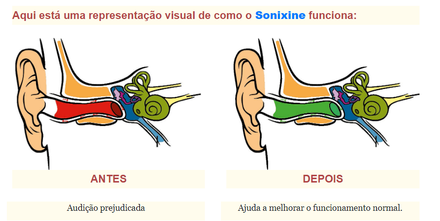 Aqui está uma representação visual de como o Sonixine funciona