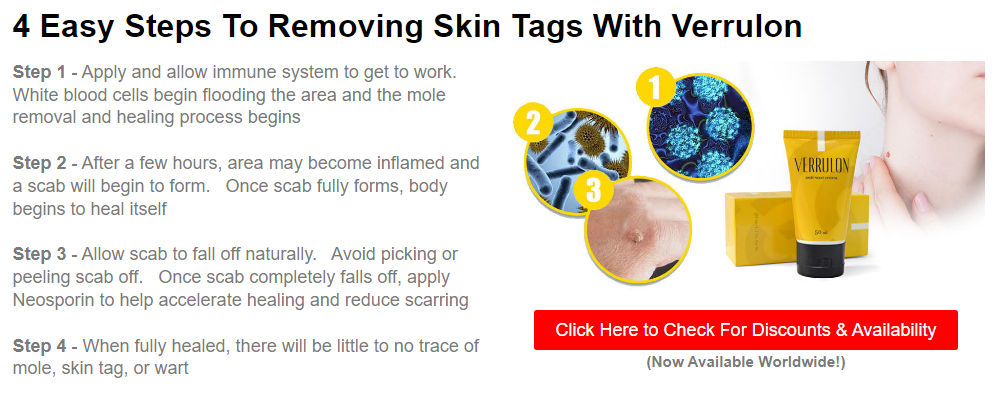 4 Easy Steps To Removing Skin Tags With Verrulon