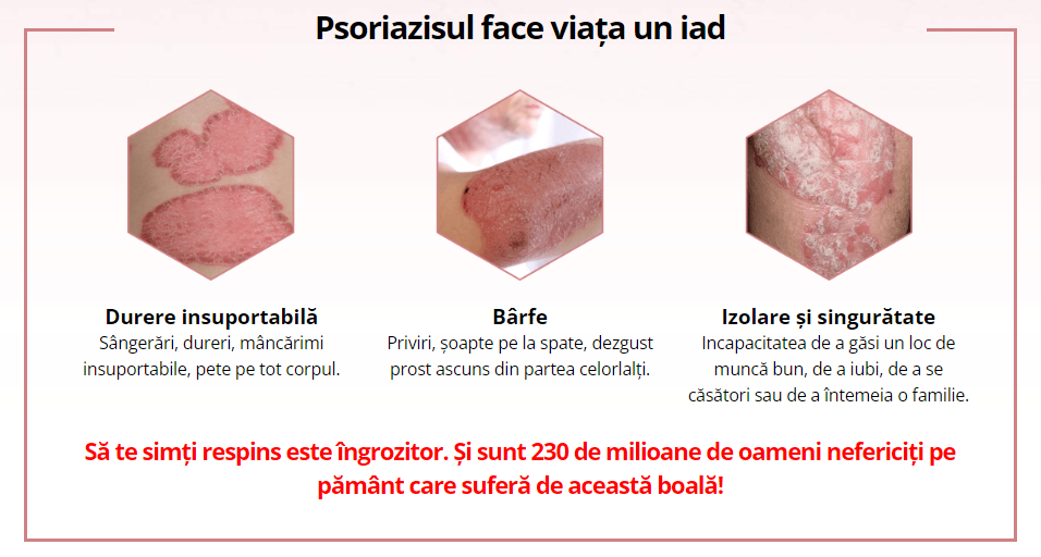 Psoriazisul face viața un iad