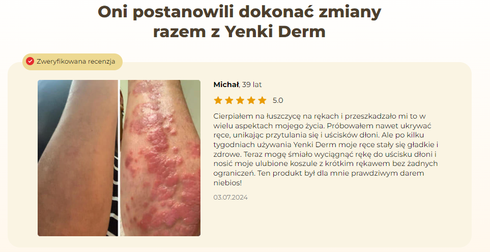 Yenki Derm Krem