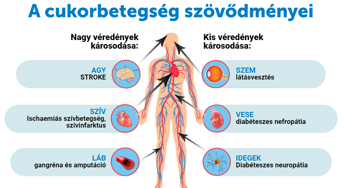 A cukorbetegség szövődményei