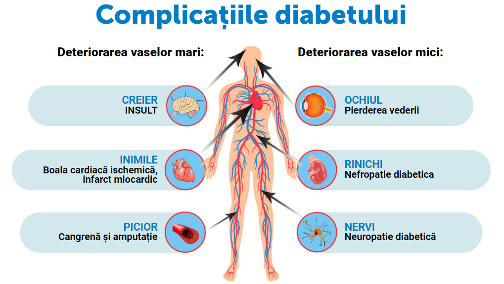 Complicațiile diabetului