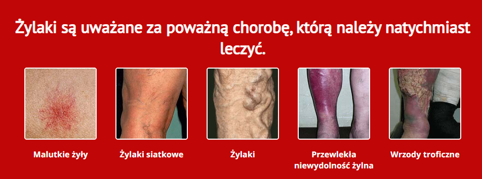 Fleboxin Gel na żyły