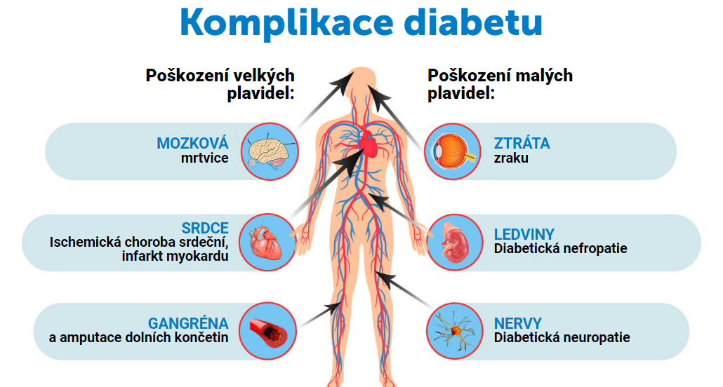 Gluconax - Komplikace diabetu