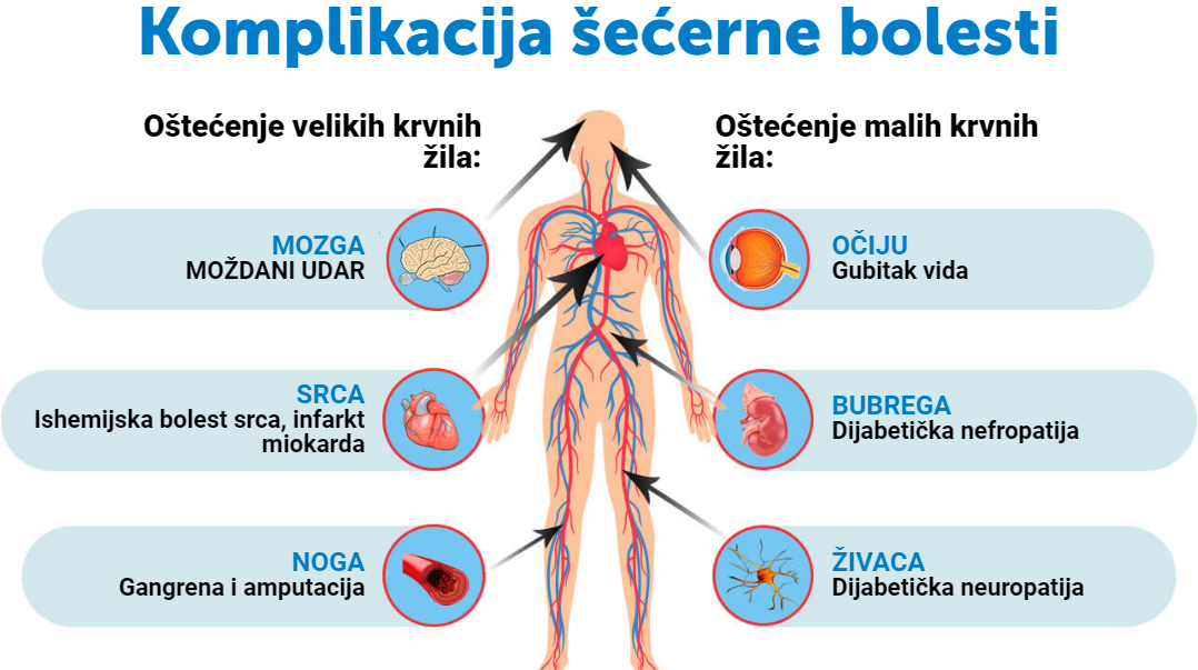 Komplikacija šećerne bolesti