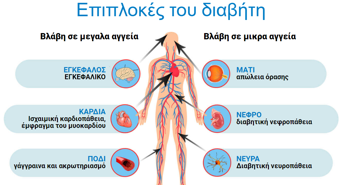 Επιπλοκές του διαβήτη