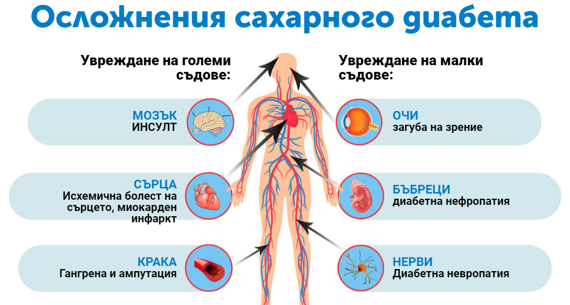 Осложнения сахарного диабета