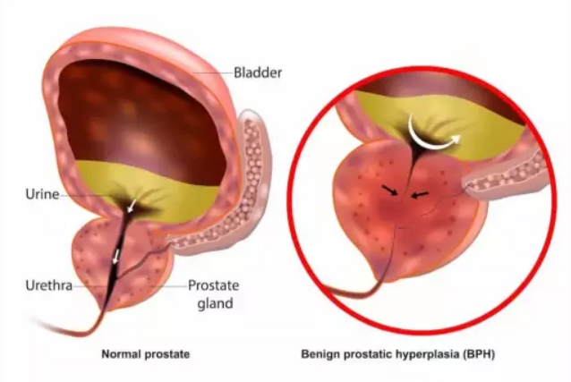 Xenoprost Active - Prostate System